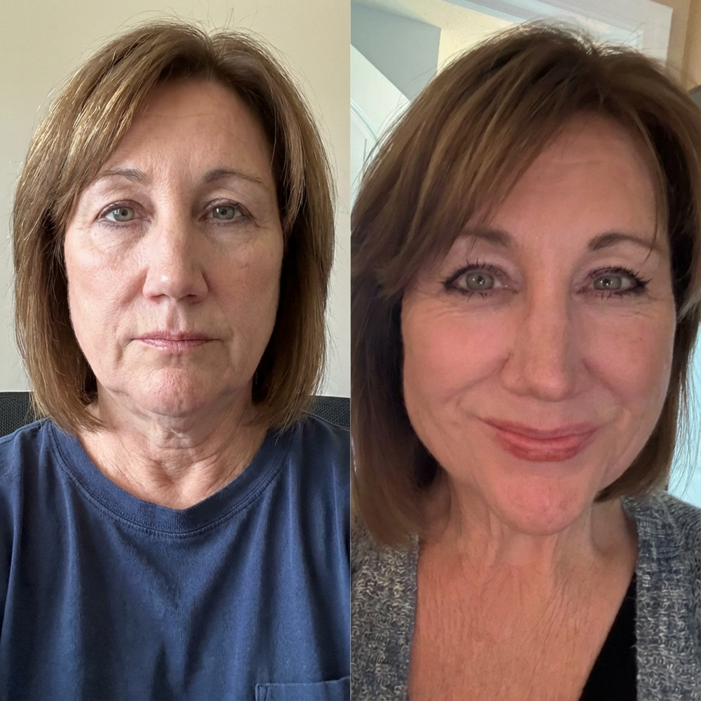 <p>OVER 50,000+ PEOPLE ARE ALREADY LOVING IT!</p>