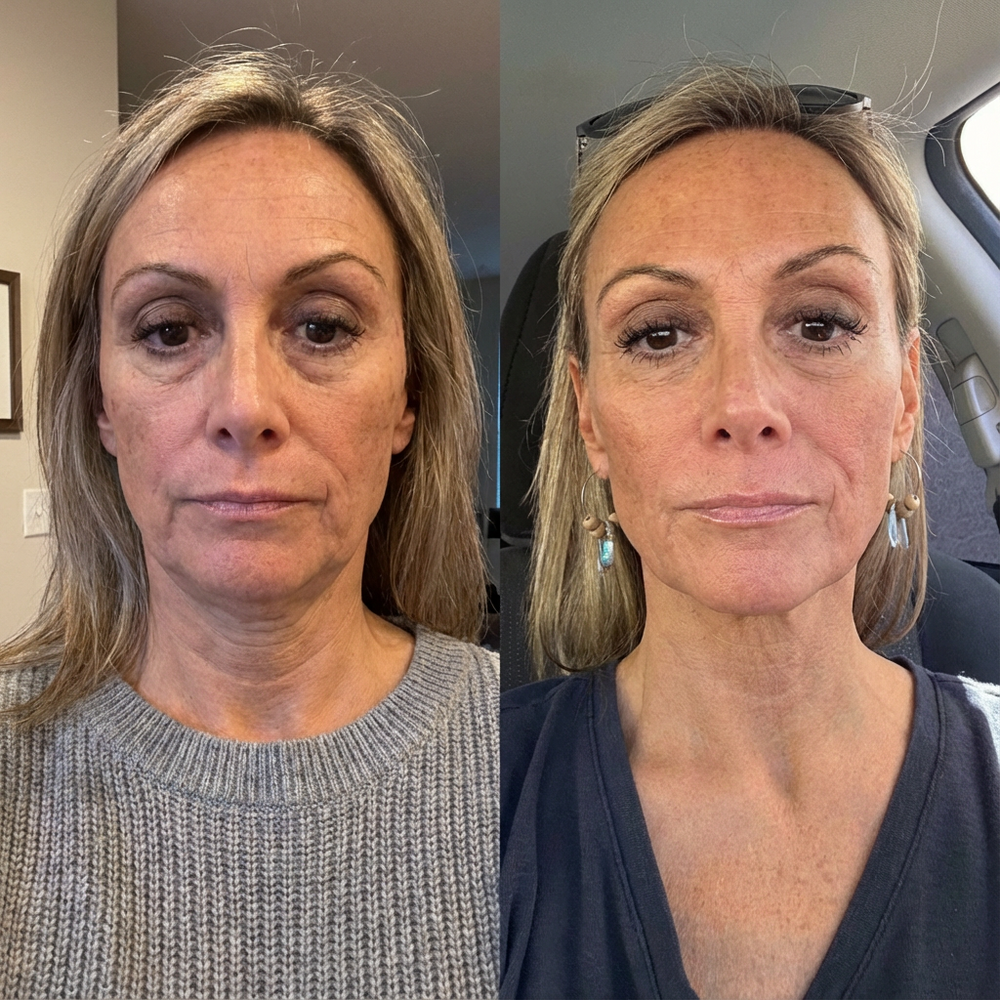 <p>OVER 50,000+ PEOPLE ARE ALREADY LOVING IT!</p>