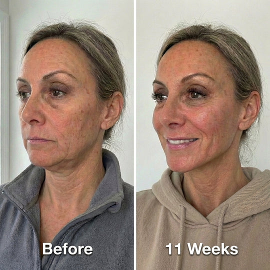Collagen Face Sculpt Wrap (BUY 1 GET 1 FREE)