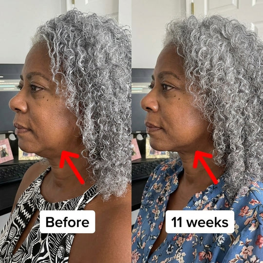Collagen Face Sculpt Wrap (Buy 1 Get 1 FREE)